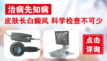 张家口白癜风医院CT皮肤机器