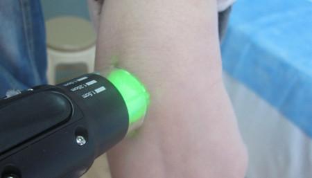 手部长白癜风是为什么原因