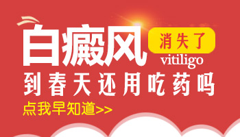 白癜风很久了能不能治好