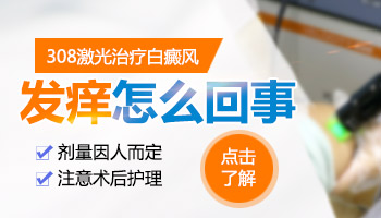 儿童白癜风治疗费用相对要高吗