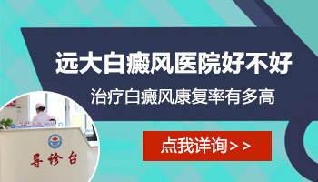 怎么确定自己的白斑是不是白癜风