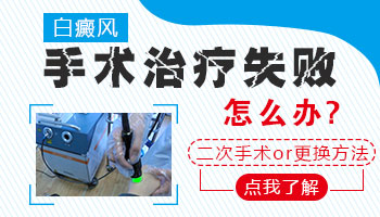 治疗妇女白癜风有哪些有效方法