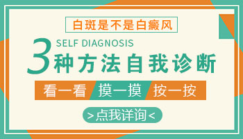 激光治疗儿童白癜风还会扩散吗