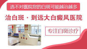孩子手脚都有白癜风医院能治好吗