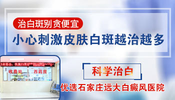 白癜风患者不要错过这3种护理方式