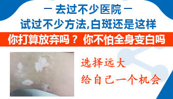 夏季治发展期白癜风的方法