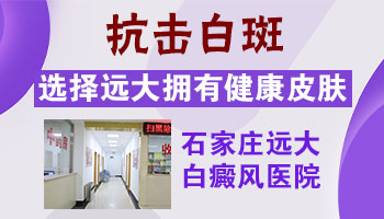 白癜风患者如何自行诊断