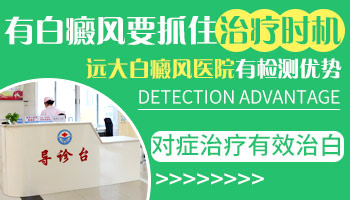 白癜风患者吃药的时候应该注意什么