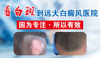 <strong>别冲动，白癜风可不是随便就能治好的</strong>