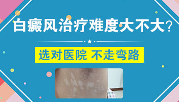 白癜风患者吃什么东西对病情有好处