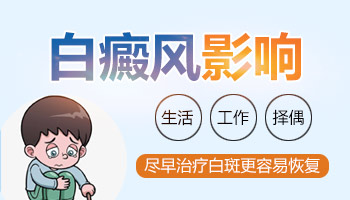 白癜风可以治疗康复吗