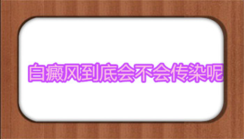 白癜风到底会不会传染呢