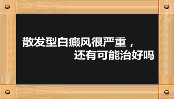 怎么治散发型白癜风比较好