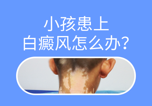 孩子4岁得了白癜风怎么办