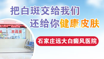邢台治疗儿童大面积白癜风的医院哪家好