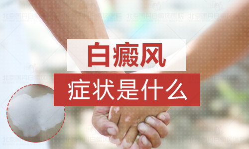 出现这种白斑80%是白癜风了