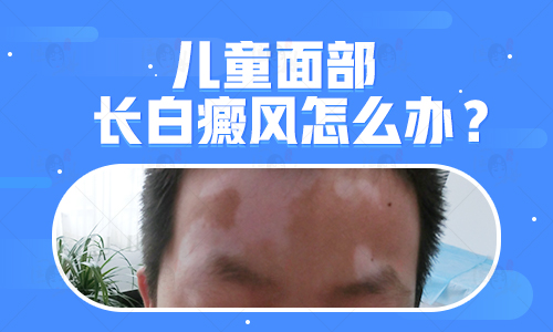 白癜风侵扰儿童青少年，破解方法看这里!
