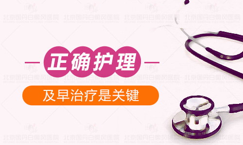 保定白癜风长在脸上要怎么护理