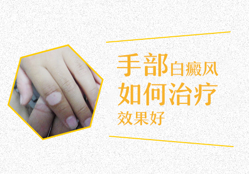  肢端型白癜风冬天用什么方法治能好