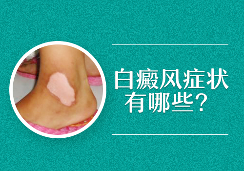 身上的白斑是什么?看完你就懂了