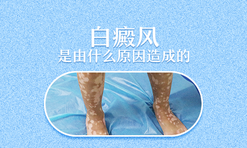 生病吃药会长白癜风吗