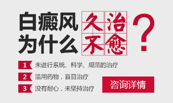 白癜风抹药