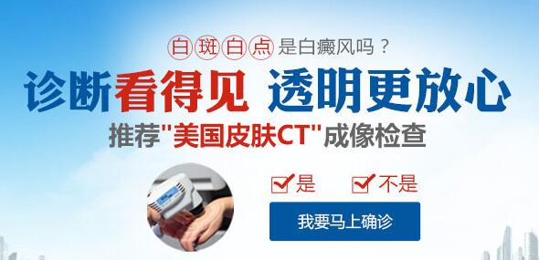 伍德灯检查正常会是白癜风