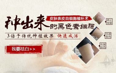  白癜风黑色素移植复发的可能性大吗