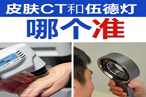 身体在伍德灯照射下有蓝色什么情况