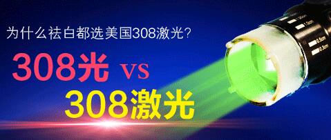 打308准分子激光治疗白癜风