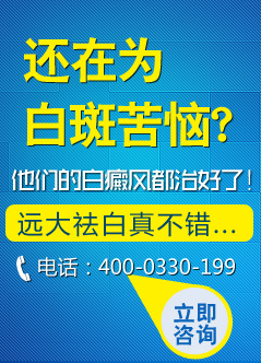 白癜风做308激光