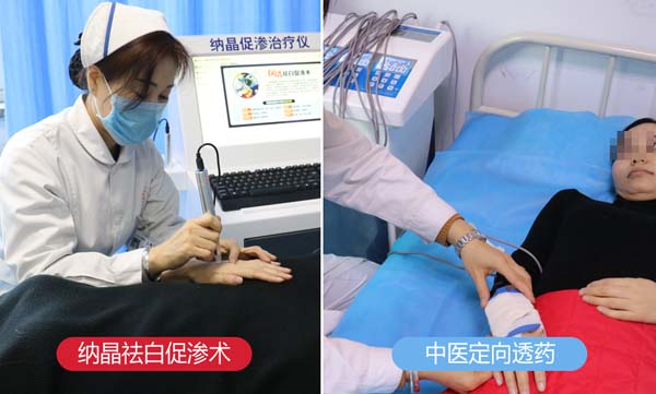 夏季白癜风防治与抗复发