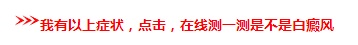 腿上有块白斑做什么检查能断定是白癜风
