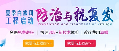 白癜风后复发