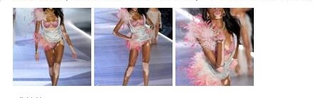 白癜风超模 这样的美丽你喜欢吗