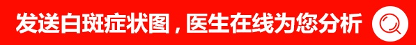 白癜风照308有的变黑能停照抹药治吗