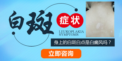 你真能区分清楚这些所谓的假“白癜风”吗