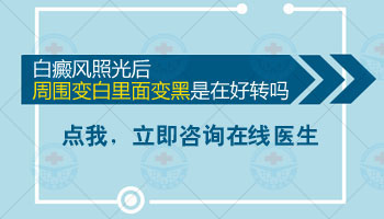 白癜风白斑内部有小黑点是不是好转现象