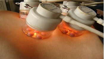 保定哪家医院种植黑色素技术好