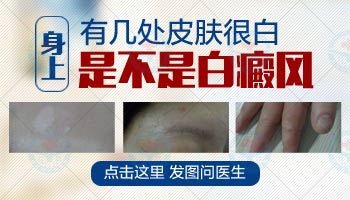 宝宝肚子上白点白斑