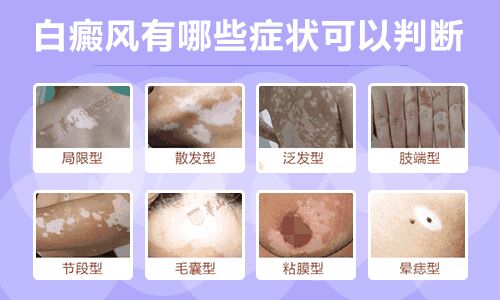 早期白斑图片