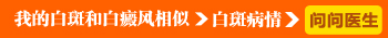 我的白斑和白癜风相似问问医生.jpg