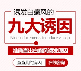 怎么检查孩子有没有被遗传白癜风