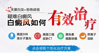 隐形白癜风用什么方法治疗好的快