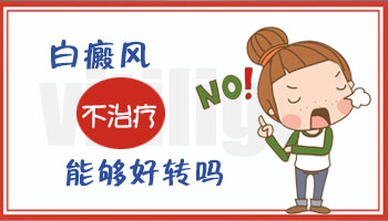白癜风能治好吗