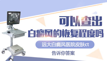 白癜风检查恢复程度