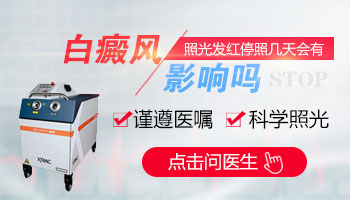 白癜风照308激光有效果了能暂停一段时间吗