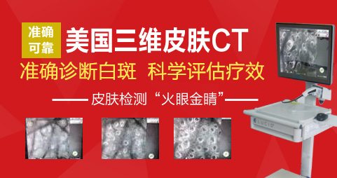 保定医院检测白斑