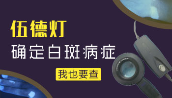 伍德灯检查白斑是不是白癜风会误诊吗