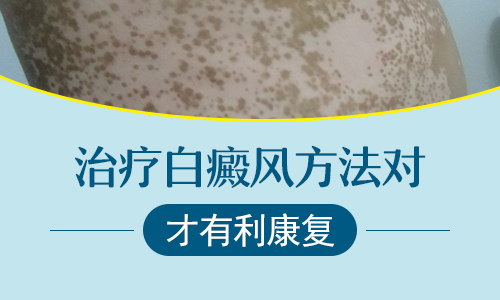 308激光和uvb哪一个治疗白癜风效果好